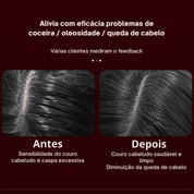 Escova de Massagem com Luz Vermelha para Queda de Cabelo