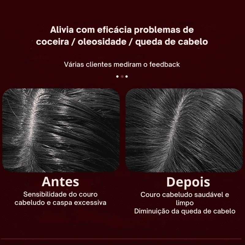Escova de Massagem com Luz Vermelha para Queda de Cabelo